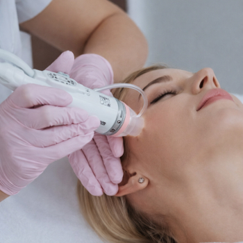 Microdermabrasion